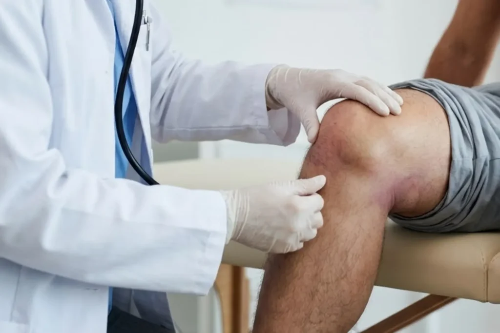 Doctor examining a visibly Swollen knee and assessing motion